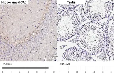 Anti-Chromogranin C antibody [HL2992] used in IHC (Paraffin sections) (IHC-P). GTX640402